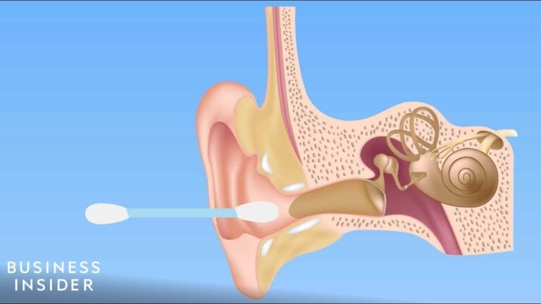 Diagram of an Ear